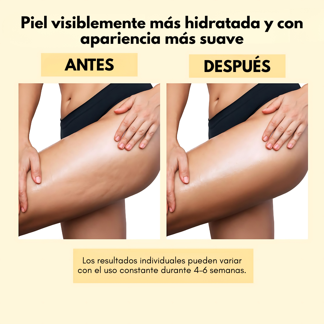 ANTI-CELLULITE MASSAGE OIL COLLAGEN – Masaje corporal, piel más firme y cuidado intensivo