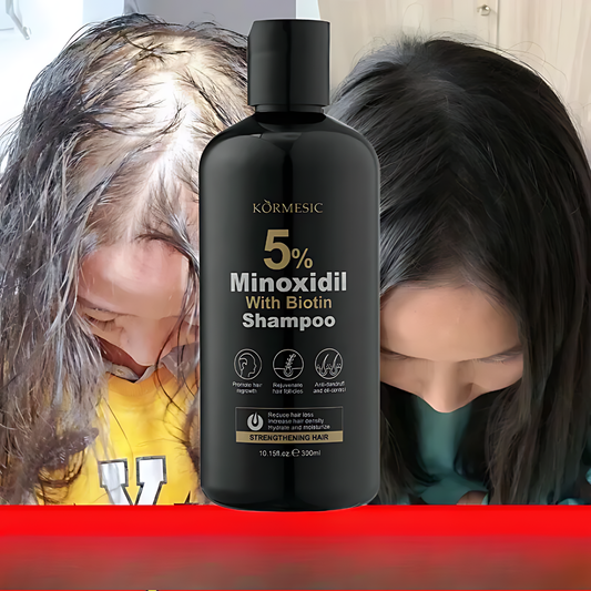 BIOTIN SHAMPOO MINOXIDIL 5% – Frena la caída y estimula el crecimiento desde la raíz