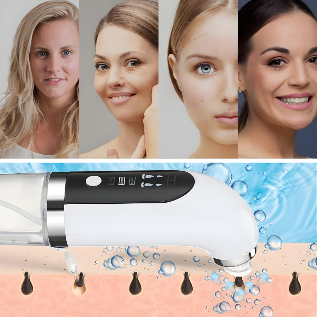 AQUASKIN PRO LIMPIADOR DE HIDRODERMOABRASIÓN – Limpieza profunda, exfoliación suave y renovación visible de la piel