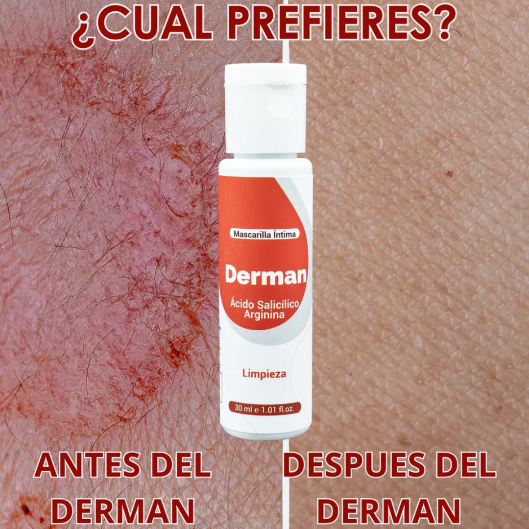 DERMAN – Mascarilla íntima purificante y antifúngica
