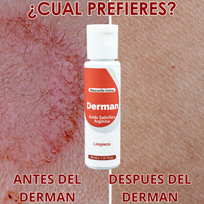 DERMAN – Mascarilla íntima purificante y antifúngica