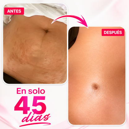 CANDELA CREAM – Firmeza visible, piel renovada y cuidado profundo desde la primera aplicación