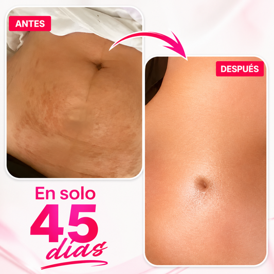 CANDELA CREAM – Firmeza visible, piel renovada y cuidado profundo desde la primera aplicación