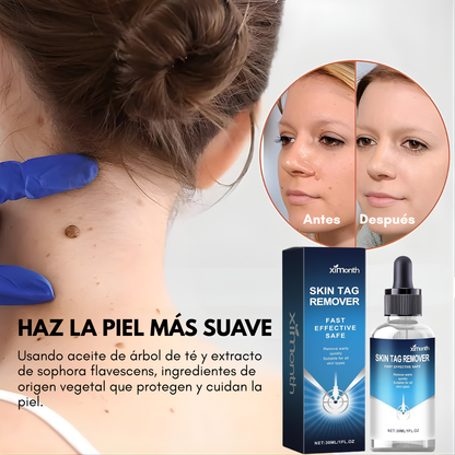 ELIMINADOR DE VERRUGAS – Piel más limpia, uniforme y segura desde casa