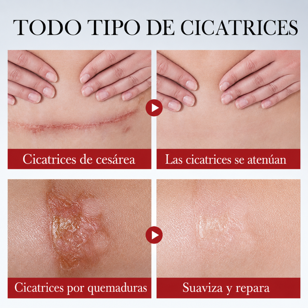 CREMA REPARADORA PROFUNDA PARA CICATRICES — Menos marcas, más piel renovada cada día
