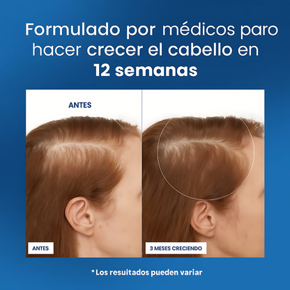 BODYWISE – Crecimiento, densidad y cuidado integral para cabello, barba y cejas