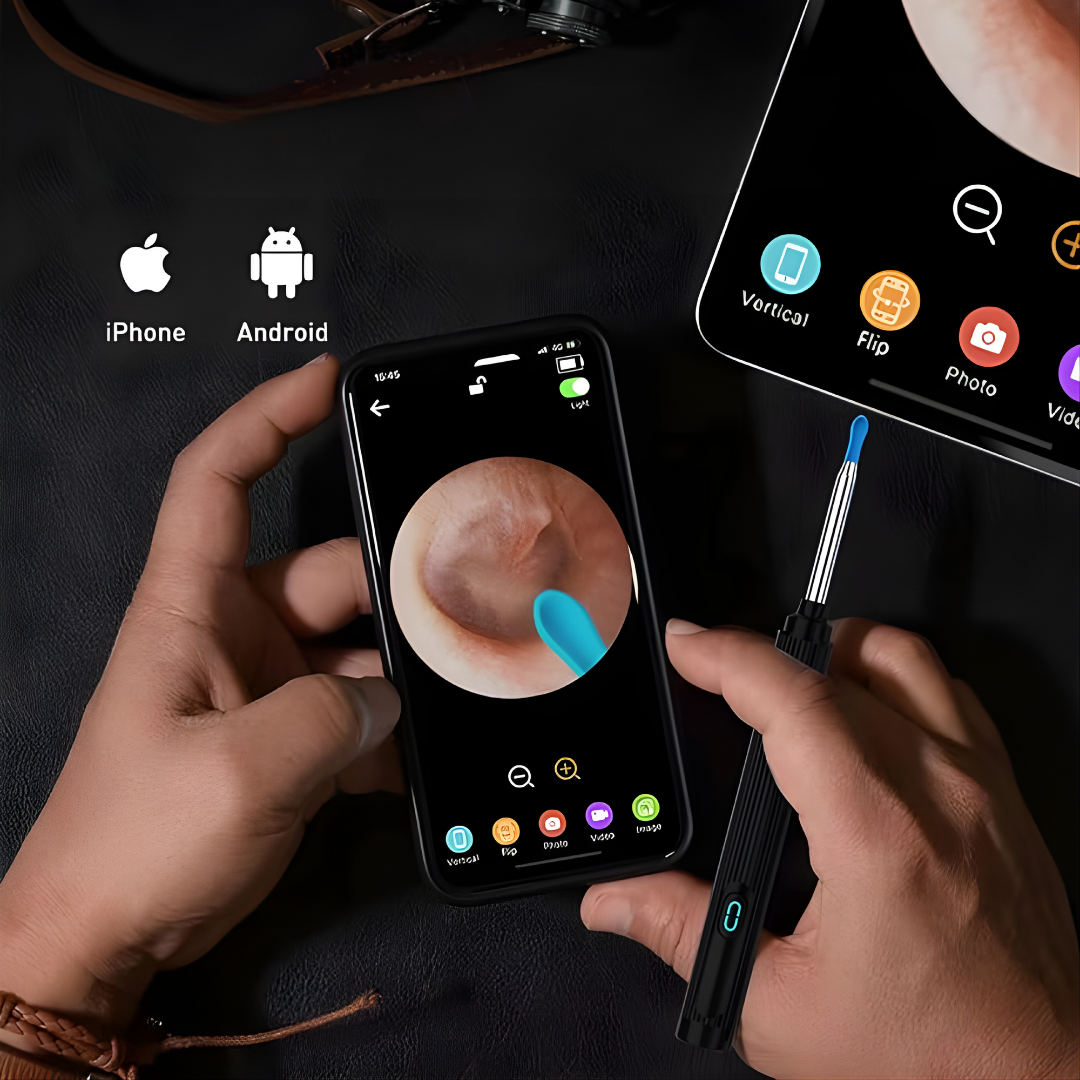 OTOSCOPIO INALÁMBRICO LIMPIADOR DE OÍDOS CON CÁMARA – Limpieza visual, control total y cuidado preciso