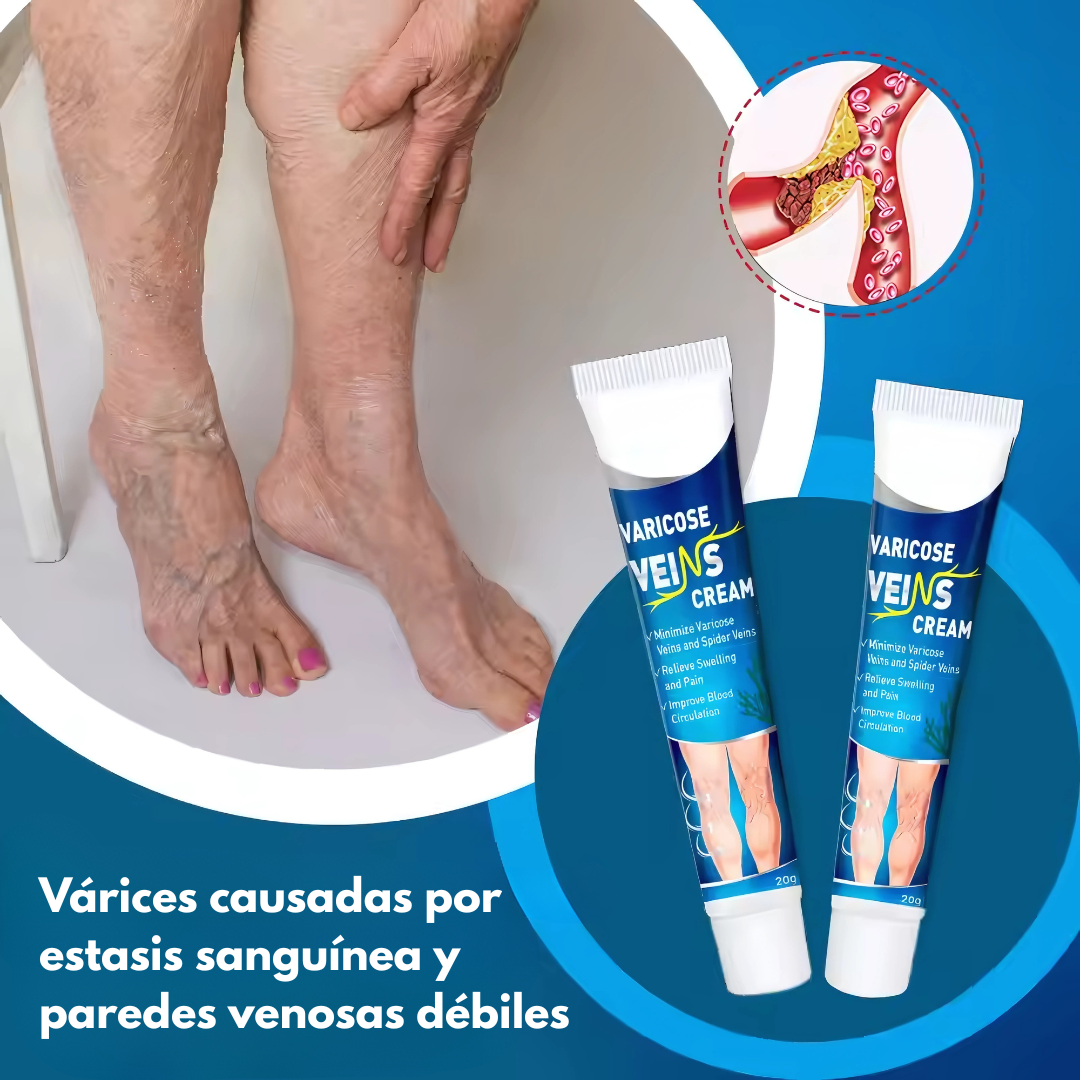 GEL PARA VENA VARICE — Alivio visible para piernas cansadas y venas