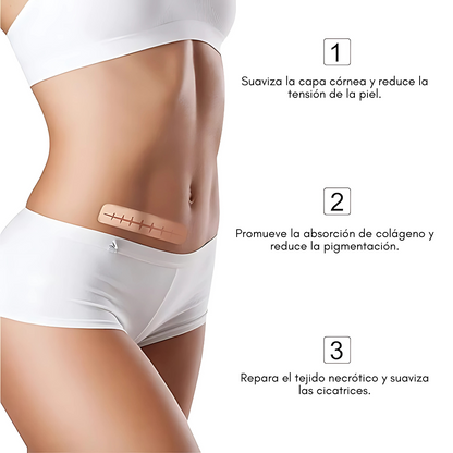 CINTA DE SILICONA PARA ELIMINAR CICATRICES – Tratamiento efectivo para cicatrices nuevas o antiguas