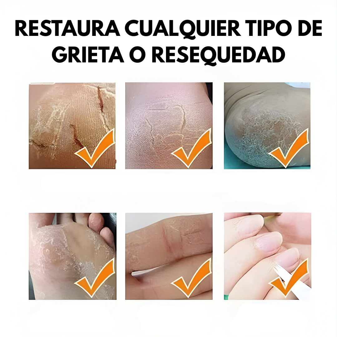 BÁLSAMO PARA TALONES AGRIETADOS – Reparación profunda, alivio inmediato y suavidad visible