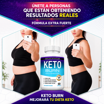 KETO BURN TOPLUX SUPLEMENTO – Apoyo keto para energía diaria