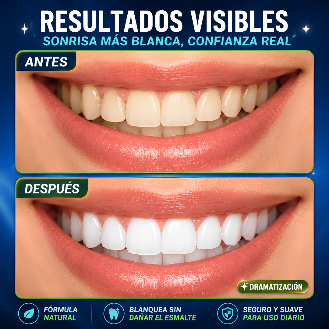 MIRACLE TEETH WHITENER BLANQUEADOR – Sonrisa más blanca naturalmente