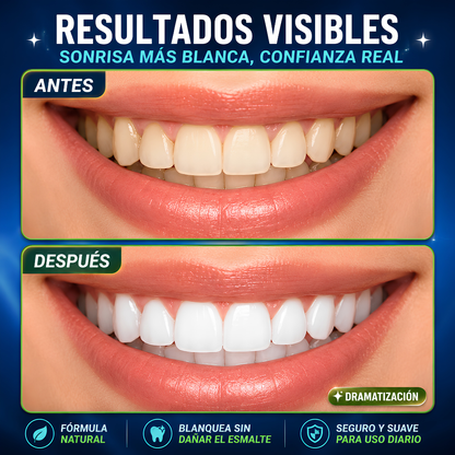 MIRACLE TEETH WHITENER BLANQUEADOR – Sonrisa más blanca naturalmente