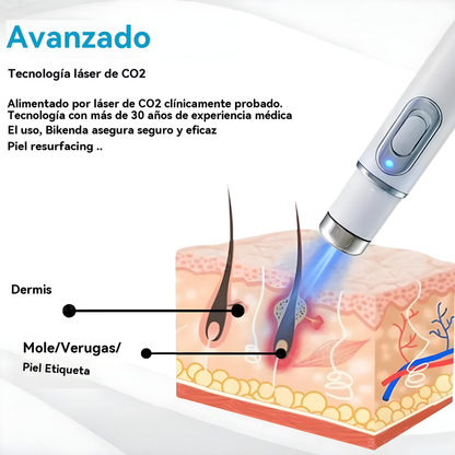 PLUMA ELIMINADORA DE ACNÉ – Regenera, suaviza y mejora el aspecto de tu piel
