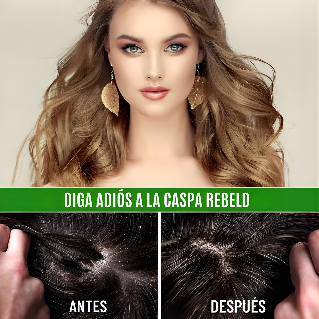 ACEITE DE BATANA – Reparación profunda, crecimiento fortalecido y brillo natural para todo tipo de cabello