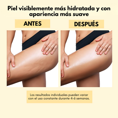 ANTI-CELLULITE MASSAGE OIL COLLAGEN – Masaje corporal, piel más firme y cuidado intensivo