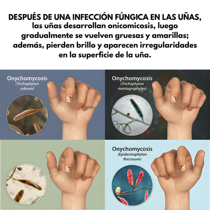 7 DÍAS DE TRATAMIENTO PARA LAS UÑAS — Cuidado intensivo para uñas más limpias y fuertes