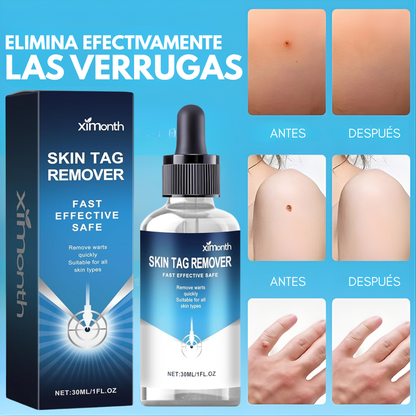 ELIMINADOR DE VERRUGAS – Piel más limpia, uniforme y segura desde casa