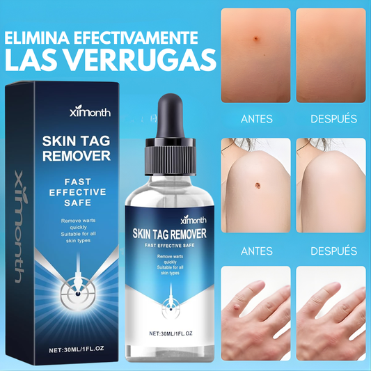 ELIMINADOR DE VERRUGAS – Piel más limpia, uniforme y segura desde casa