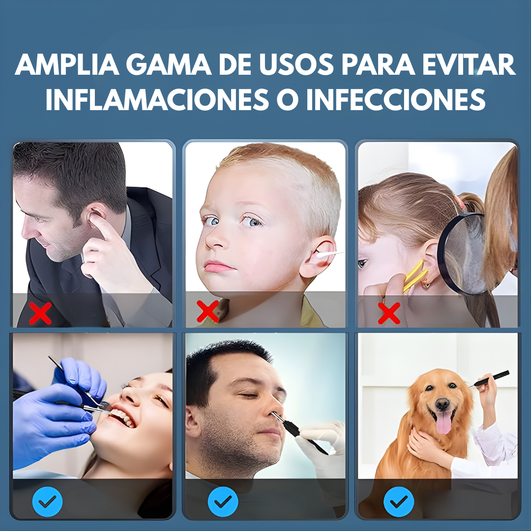 OTOSCOPIO INALÁMBRICO LIMPIADOR DE OÍDOS CON CÁMARA – Limpieza visual, control total y cuidado preciso