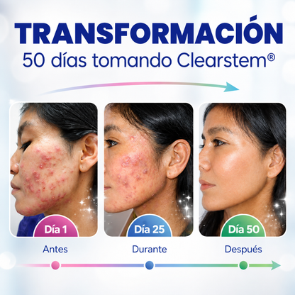 CLEARSTEM MINDBODYSKIN 90 CAPS – Equilibrio interno, piel más limpia y control del acné hormonal desde la raíz