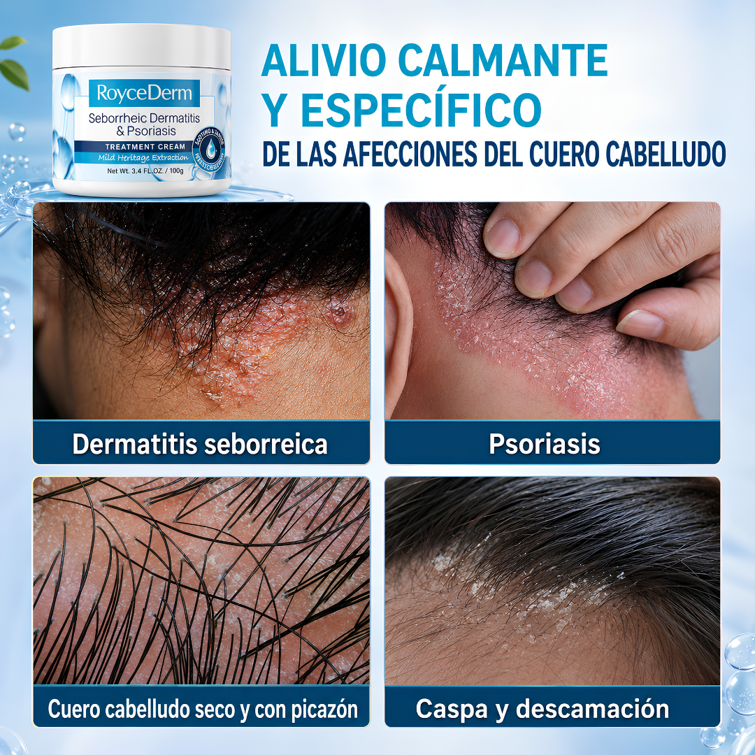 CREMA PARA DERMATITIS SEBORREICA Y PSORIASIS – Calma, hidrata y protege