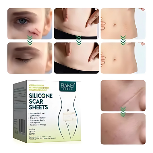 CINTA DE SILICONA PARA ELIMINAR CICATRICES – Tratamiento efectivo para cicatrices nuevas o antiguas
