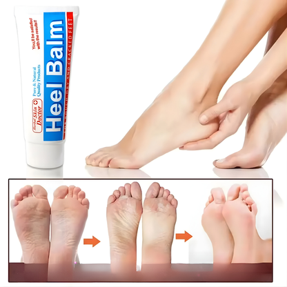 BÁLSAMO PARA TALONES AGRIETADOS – Reparación profunda, alivio inmediato y suavidad visible