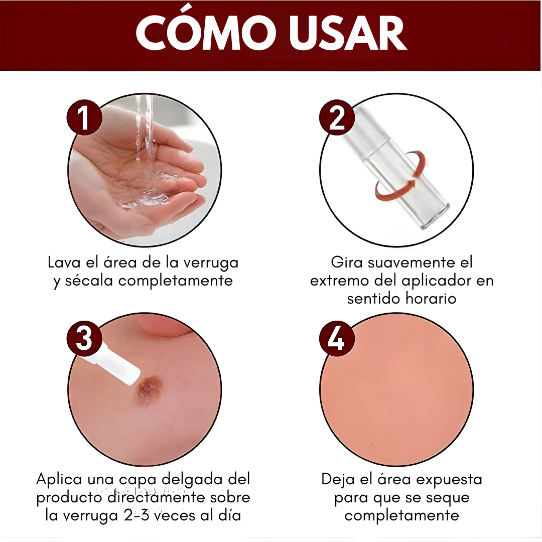 BOLÍGRAFO PARA EL CUIDADO DE VERRUGAS – Apoyo estético para marcas visibles, aplicación precisa y piel con mejor apariencia