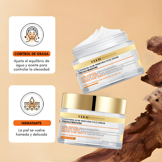 CREMA FACIAL ANTI-ACNE YSKM – Limpieza profunda, control del acné y piel más uniforme día a día