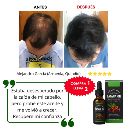 ACEITE DE BATANA – Reparación profunda, crecimiento fortalecido y brillo natural para todo tipo de cabello