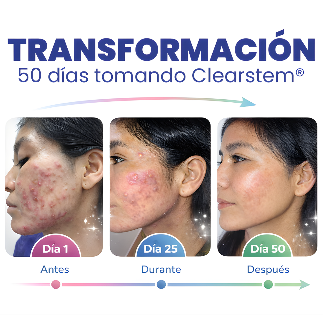 CLEARSTEM MINDBODYSKIN*90 CAP – Equilibrio interno, piel más limpia y control del acné hormonal desde la raíz