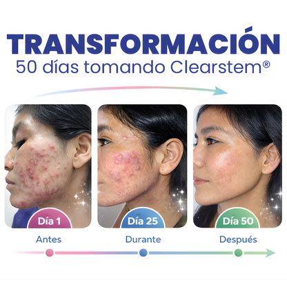 CLEARSTEM MINDBODYSKIN*90 CAP – Equilibrio interno, piel más limpia y control del acné hormonal desde la raíz