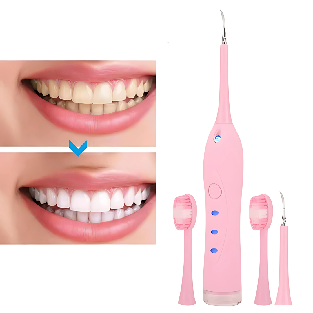 REMOVEDOR ELÉCTRICO DE CÁLCULOS DENTALES ESCALADOR ULTRASÓNICO – Dientes limpios y sin sarro sin salir de casa