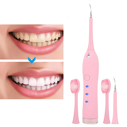 REMOVEDOR ELÉCTRICO DE CÁLCULOS DENTALES ESCALADOR ULTRASÓNICO – Dientes limpios y sin sarro sin salir de casa