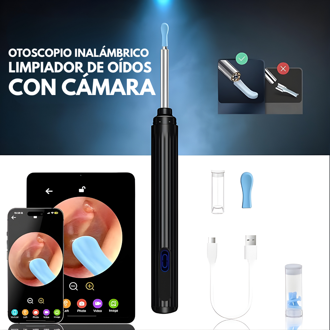 OTOSCOPIO INALÁMBRICO LIMPIADOR DE OÍDOS CON CÁMARA – Limpieza visual, control total y cuidado preciso