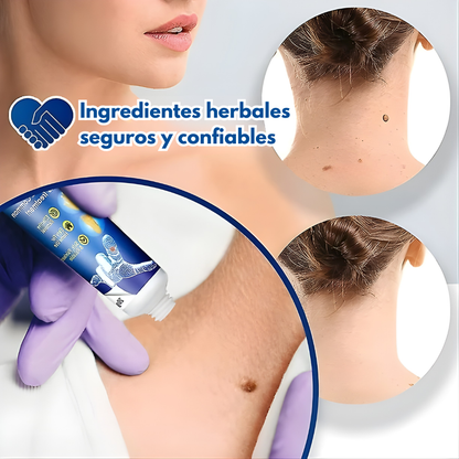 TRATAMIENTO PARA VERRUGAS (WART REMOVER) – Aplicación precisa, acción localizada y cuidado práctico en casa