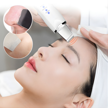 ESPÁTULA ULTRASÓNICA FACIAL – Limpieza profunda, poros más finos y piel suave sin irritación
