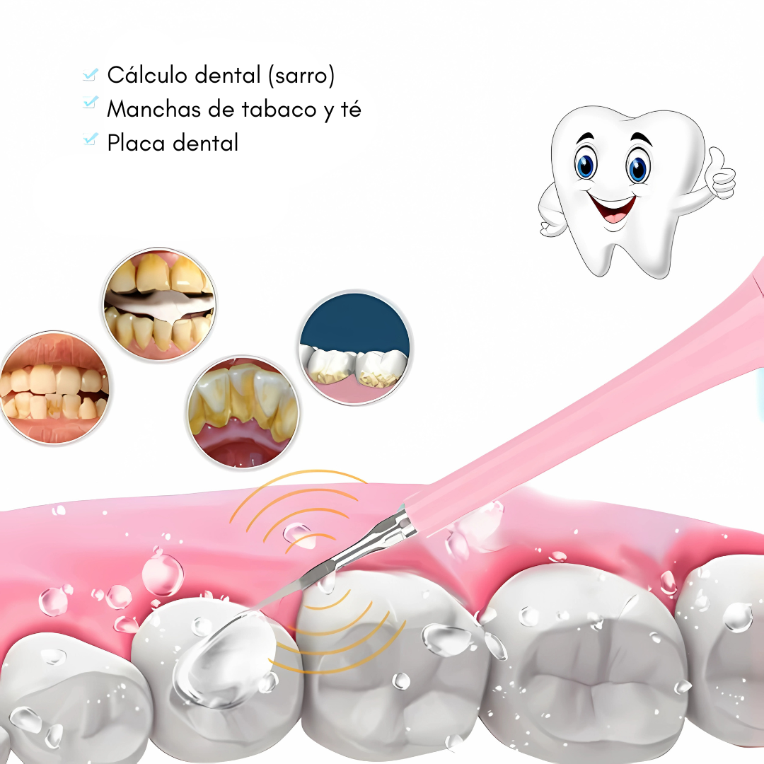 REMOVEDOR ELÉCTRICO DE CÁLCULOS DENTALES ESCALADOR ULTRASÓNICO – Dientes limpios y sin sarro sin salir de casa