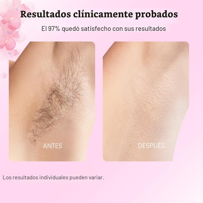 ACEITE DE CYPERUS ROTUNDUS – Reducción progresiva del vello, piel más suave y cuidado natural en cada aplicación