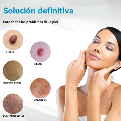 PLUMA ELIMINADORA DE ACNÉ – Regenera, suaviza y mejora el aspecto de tu piel