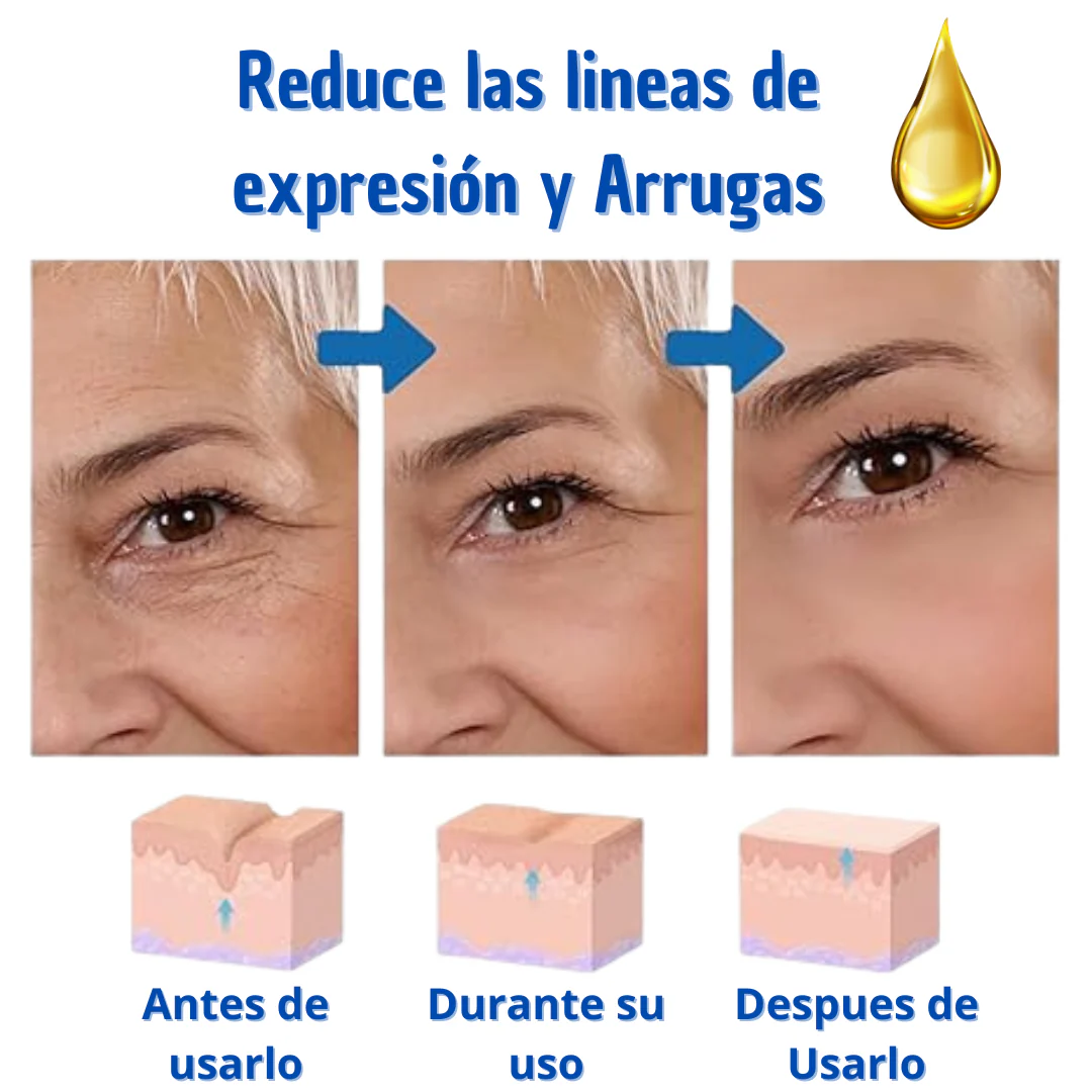 BOTOX SUERO ANTIEDAD - Levanta y reafirma tu piel para desafiar el paso del tiempo y resaltar tu luminosidad.